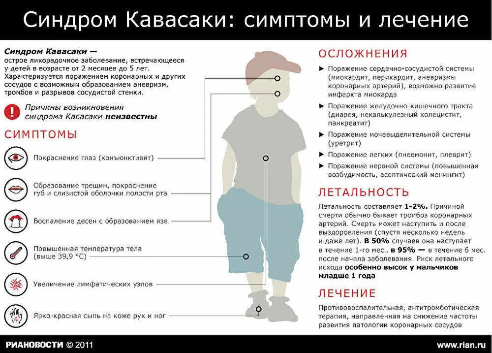 Синдром Кавасаки симптомы. Болезнь Кавасаки у детей симптомы. Какие осложнения после ковида