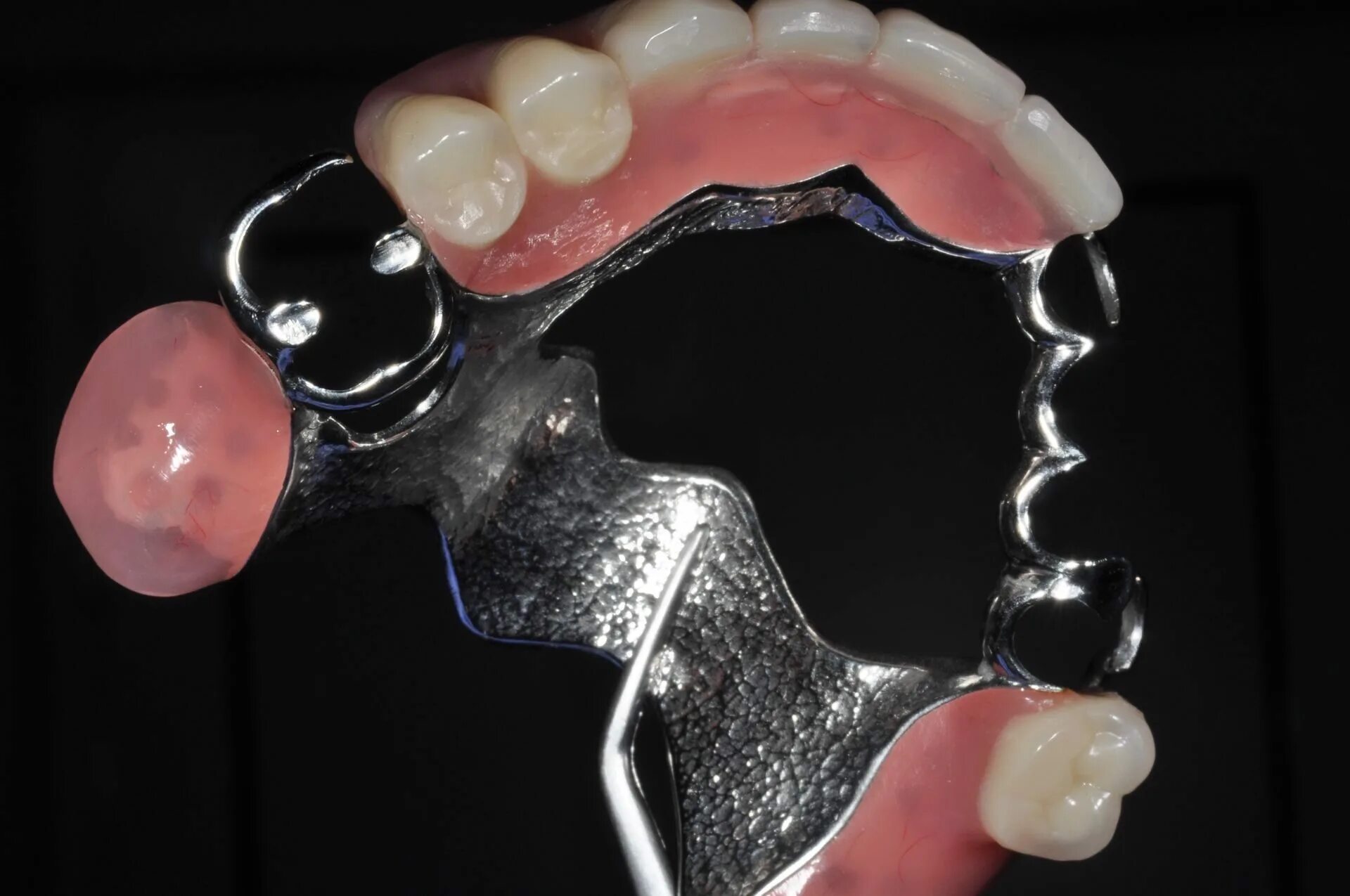 протез управляется миоэлектрическими токами. протез с опорой на импланты. протезы 2 группы 2. протезы 2 группы 2. Honda walking assist.