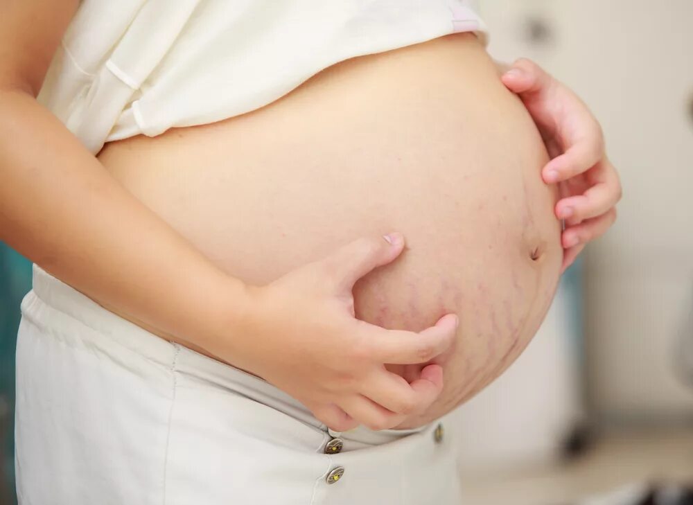 Зуд после беременности. Живот беременной. Дерматоз у беременной на животе. Дерматит на животе при беременности.