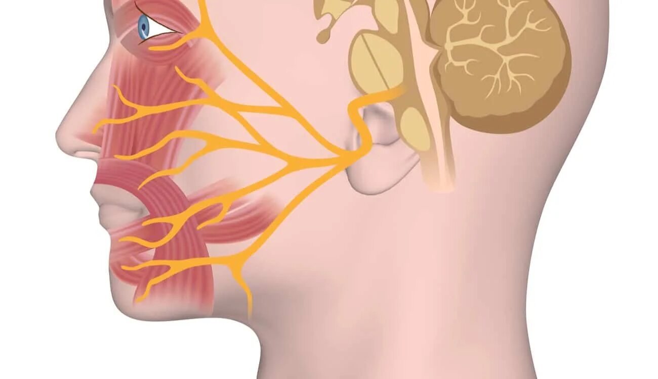 Левый лицевой нерв. Невропатия (неврит) лицевого нерва.. Тригеминальная невралгия. Неврит воспаление лицевого нерва. Невралгия ушного узла тройничного нерва.