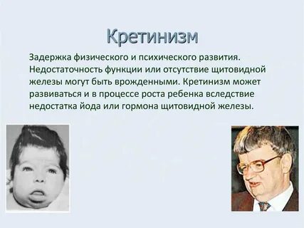 Дефицит психологического развития