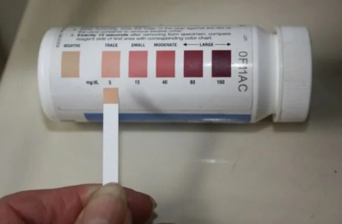 Кетоны в моче у мужчины. Тест полоски кетоновые ацетон. Полоски на ацетон Кетоглюк. Тест полоски на кетоновые тела в моче. Тест полоски Кетоглюк.