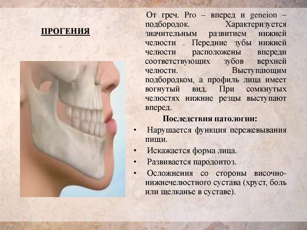 Правильное положение нижней челюсти. Строение челюсти прогения прогнатия. Прикус прогенический мезиальный. Прогения нижней челюсти. Прогенический прикус кратко.