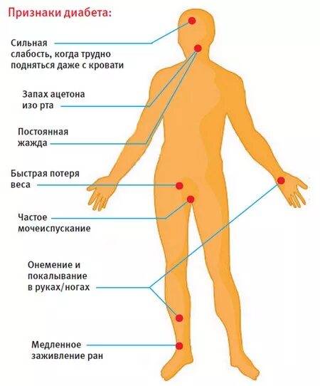 Симптомы диабета у мужчин до 30