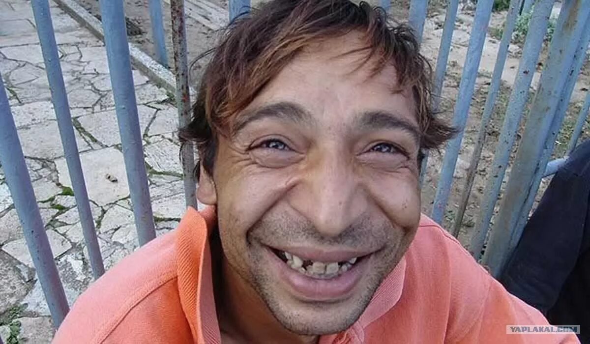 Бомж виталий. Зубы алкаша. Зубы алкаша. Грузин улыбается. Зубы алкаша.