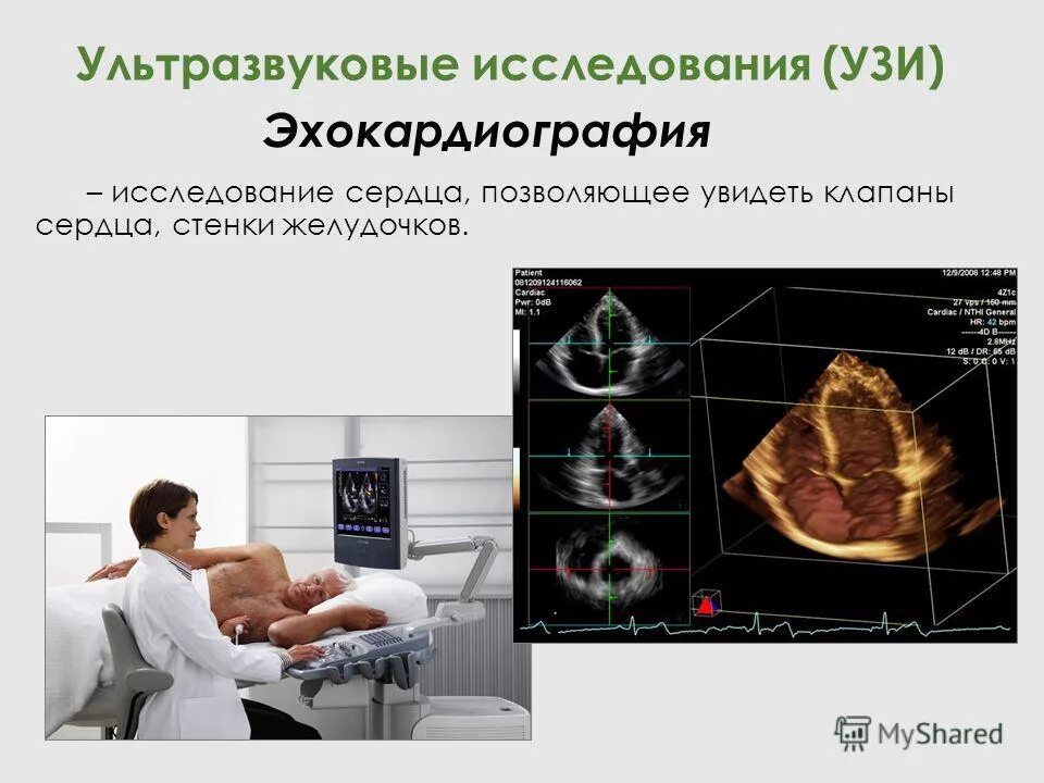 Эхокардиография эхо кг сердца что это. Узи в кардиологии. Эхокардиография метод исследования. Узи сердца (эхокардиография). Ультразвуковое исследование сердца.