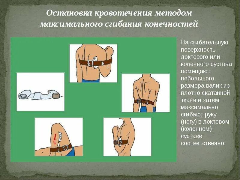 Доврачебная помощь при ранениях кровотечениях. Сгибание конечности при кровотечении. первая помощь при ранениях.