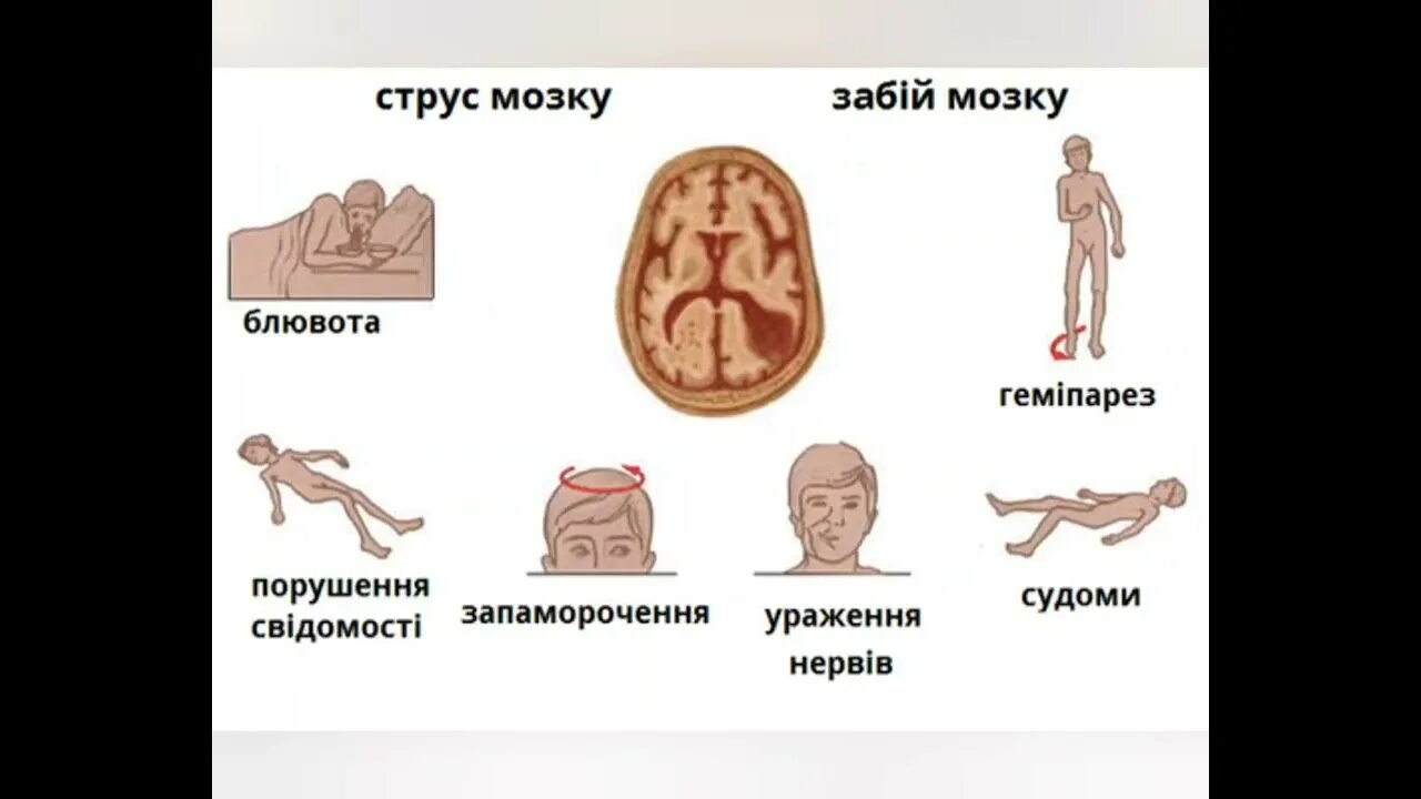 Что делать при ударе по голове