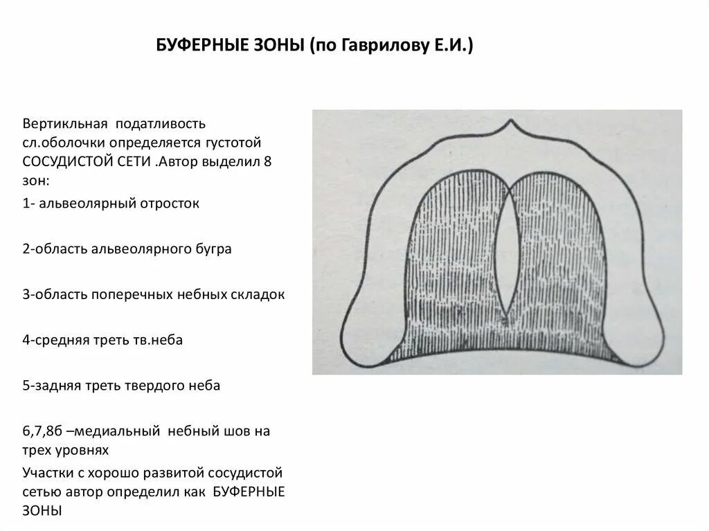 Теория буферных зон по Гаврилову. Зона податливости слизистой оболочки по Гаврилову. Буферные зоны слизистой оболочки. Топография буферных зон слизистой оболочки по е.и.Гаврилову. Люнд слизистой оболочки