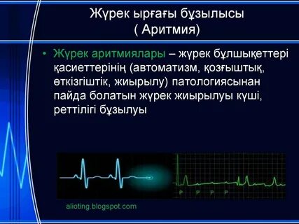 Экг автоматизм