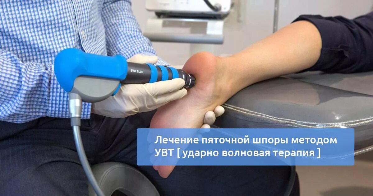 УВТ ударно волновая пяточной шпоры. Ударно волновая терапия плантарный фасциит. Ударно-волновая терапия (УВТ) пяточной шпоры. УВТ ударно волновая терапия пяточная шпора.