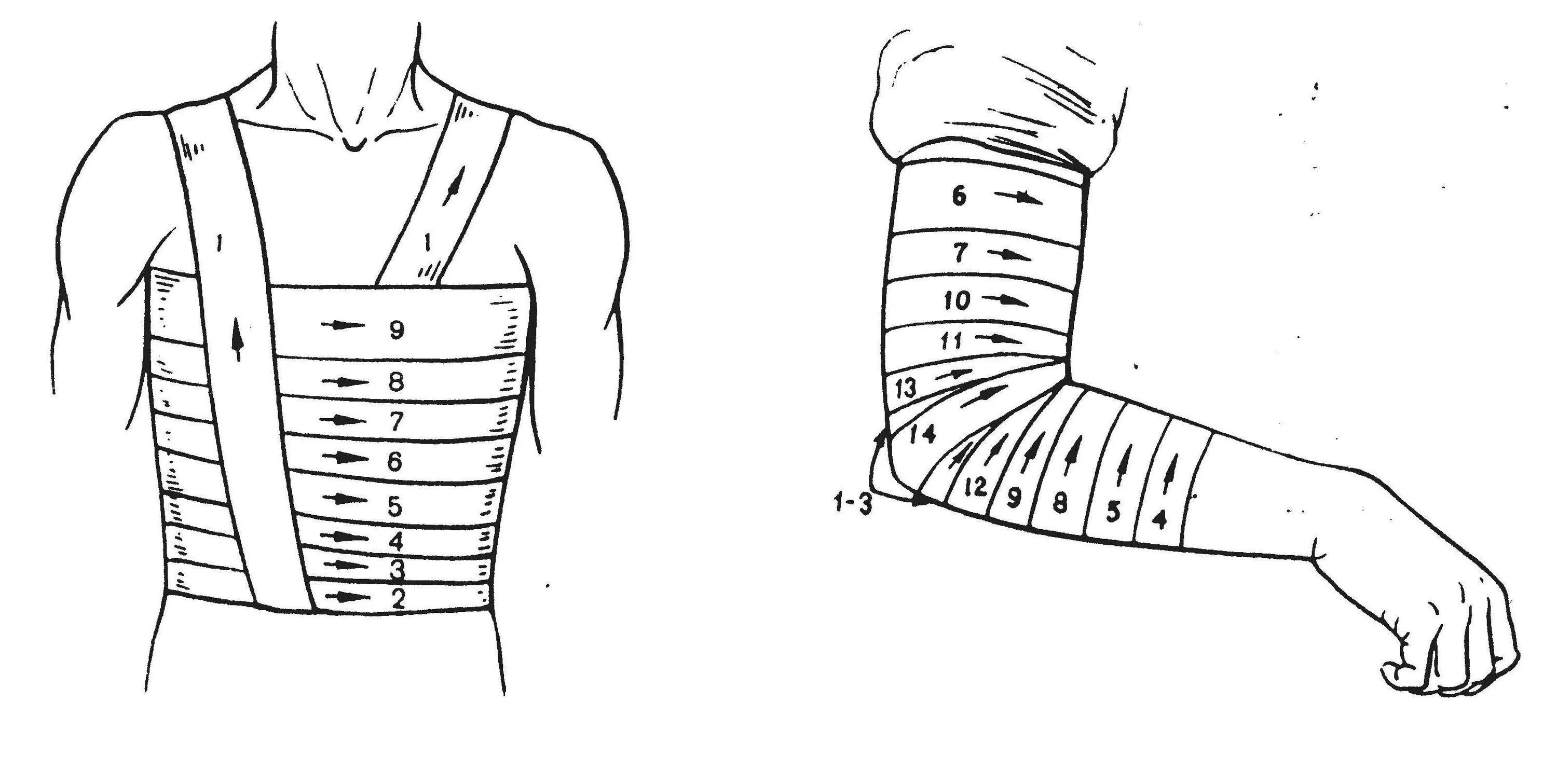 Повязка на грудную клетку алгоритм. Бинтовой спиралевидно повязки. Бинтовая повязки спиралевидная на предплечье. Технология наложения повязок сральнаяпи. Наложение бинтовых повязок: спиральная;.