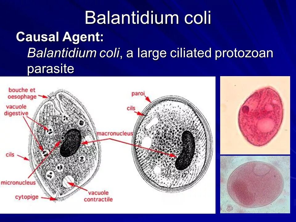 Трофозоит balantidium coli. Балантидиум коли. Циста балантидия строение. Кишечный балантидий морфология. Balantidium coli строение.