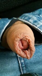 Free My Uncut foreskin. 