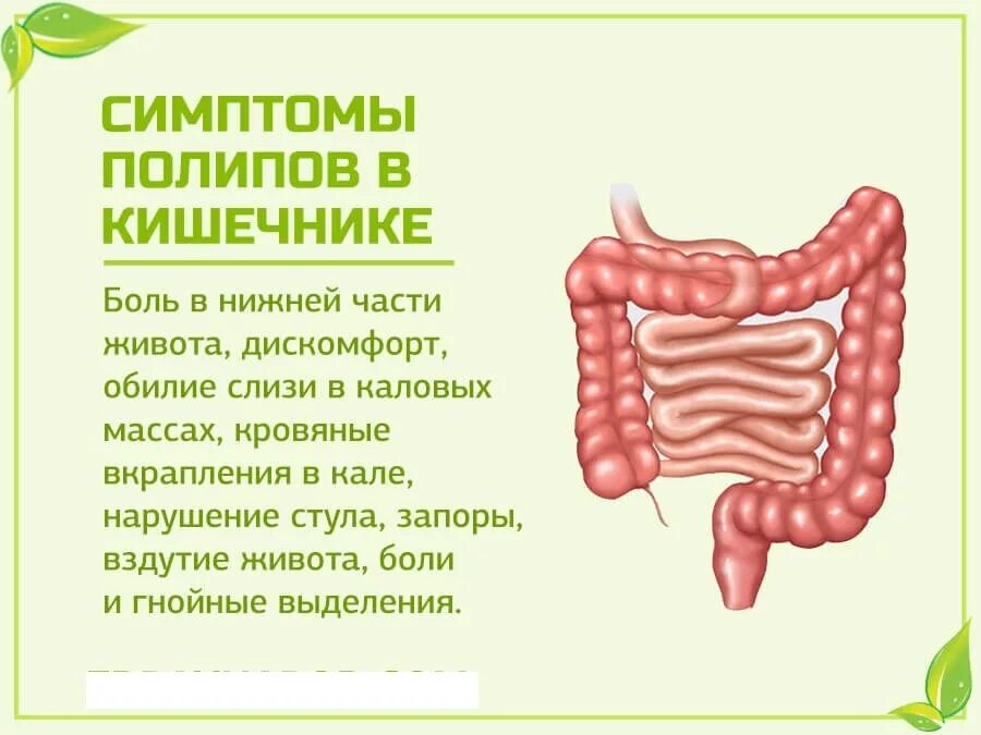 Почему крови кишечник. Полип кишечника прямой кишки. Полипы в кишечнике симптомы. Полипы Толстого кишечника.