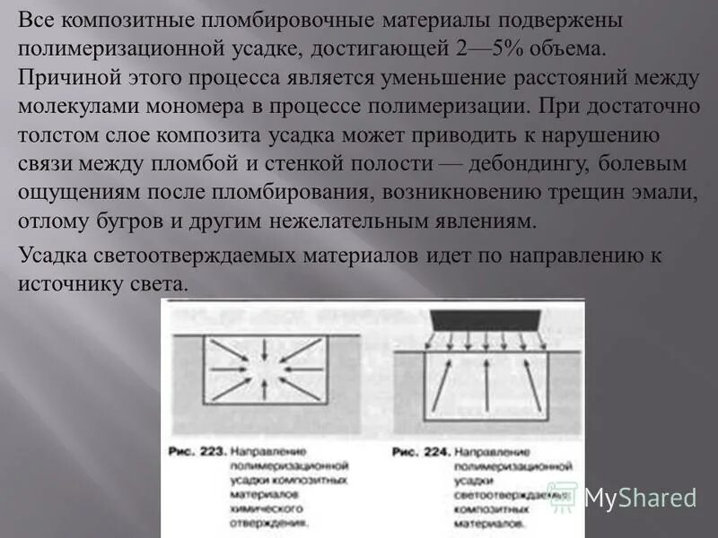 полимеризационный стресс в стоматологии. усадка материала в стоматологии. полимеризационная усадка. усадка композита. полимеризационная усадка композитов.