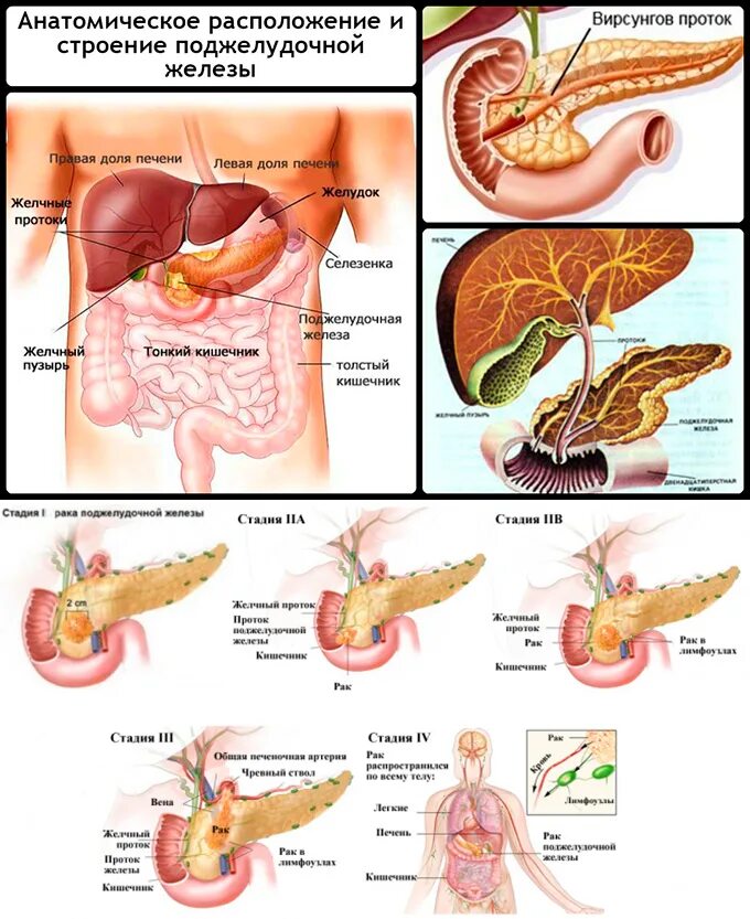 4 стадия поджелудочной железы сколько живут. Злокачественное новообразование тела поджелудочной железы. T3n0m0 головки поджелудочной железы. Злокачественные новообразования поджелудочной железы. Операбельные опухоли поджелудочной железы.