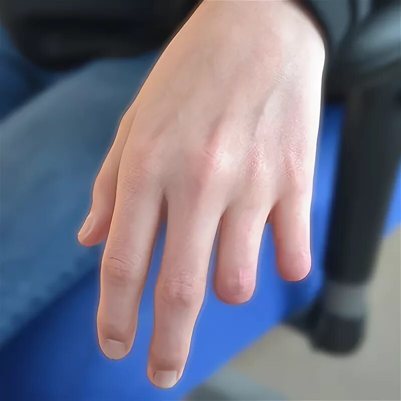 Эластичный напальчник медицинский. Помощь без пальцев. Аннет гэббеди. Как определить время по пальцам и солнцу. Помощь без пальцев.