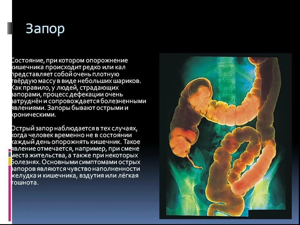 Почему происходит запор. Опорожнение прямой кишки.