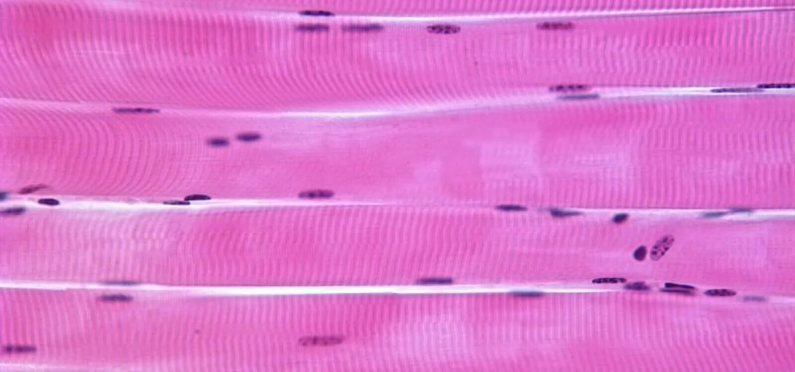 Поперечно-полосатая Скелетная мышечная ткань гистология. Поперечнополосатая Скелетная мышечная ткань гистология. Скелетная мышечная ткань гистология. Скелетная мышечная ткань гистология препарат. Препарат поперечно полосатая мышечная ткань