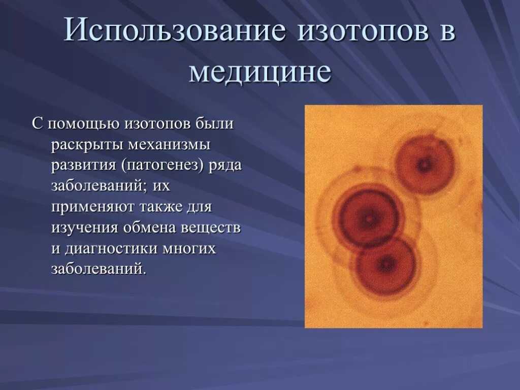 Использование радиоактивных изотопов в медицине презентация