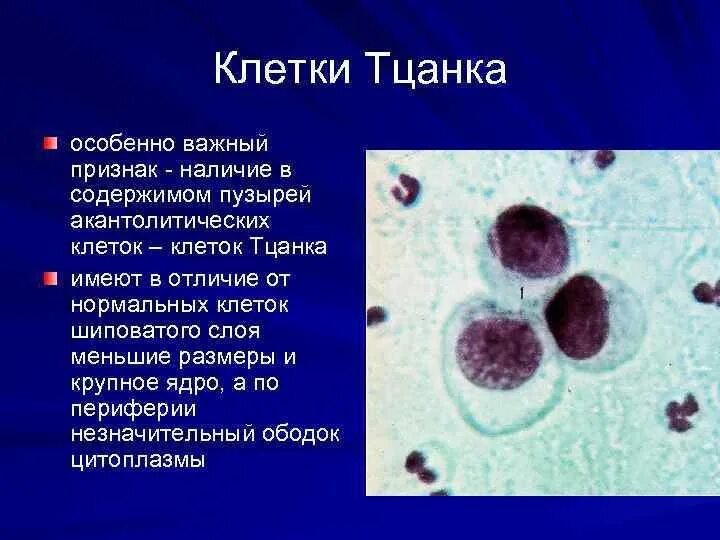 Клетки тцанка