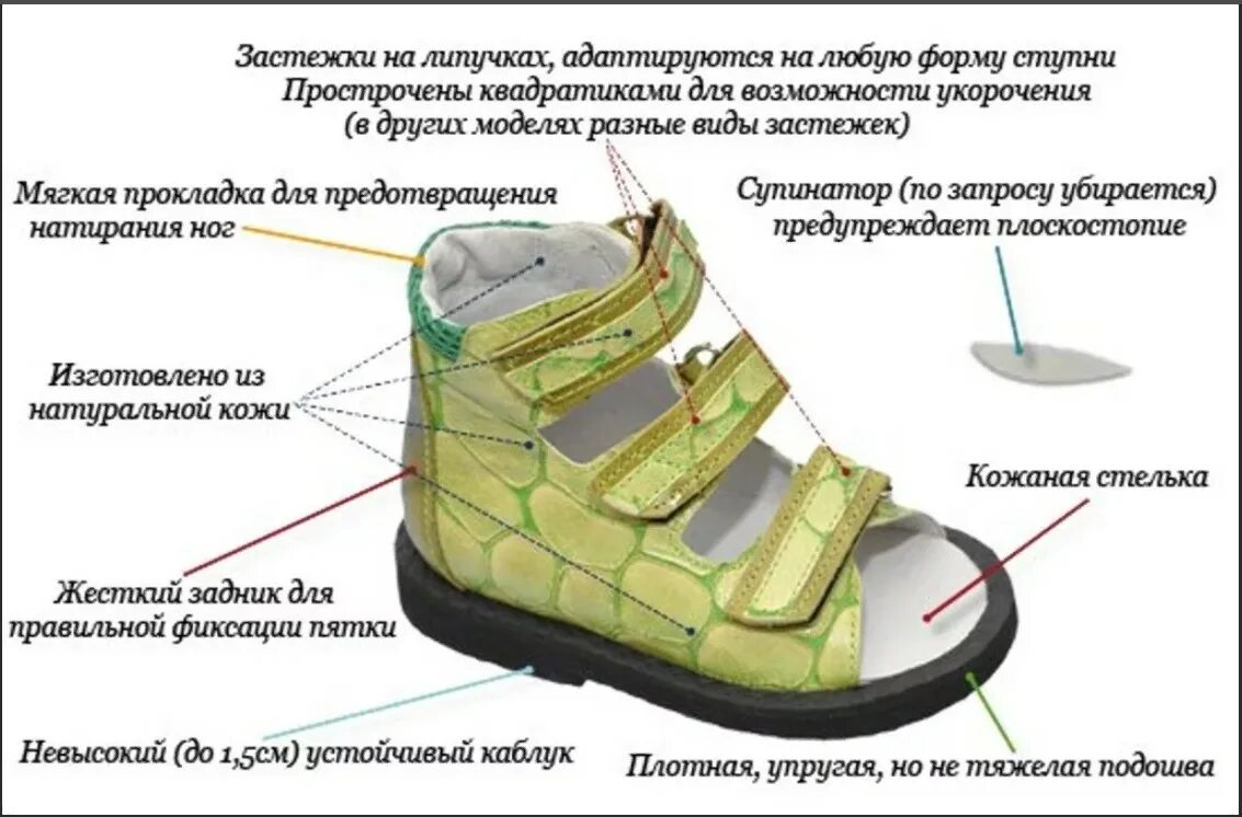 Какой обувь надо. Ортопедическая обувь для детей при вальгусной деформации. Ортопедическая обувь при косолапии. Правильная ортопедическая обувь для детей. Ортопедические обуви схема.