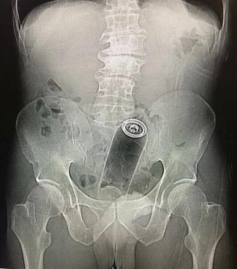 Разорвать юный. Насильник несовершеннолетний. Разорвать юный. Половые. Mischa brooks 2013.