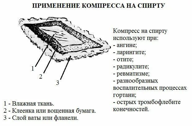 Как проверить правильность наложения влажного согревающего компресса. Водочный компресс как правильно делать. функциональные слои компресса. спиртовой компресс на горло. полуспиртовой компресс.