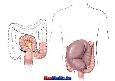 Тұшпара сияқты киска