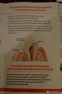 Чувствительные зубы что делать