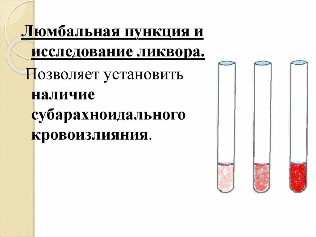 Ликвор при субарахноидальном. Субарахноидальное кровоизлияние люмбальная пункция. Спинномозговая жидкость при субарахноидальном кровоизлиянии. Ликвор при субарахноидальное кровоизлияние.