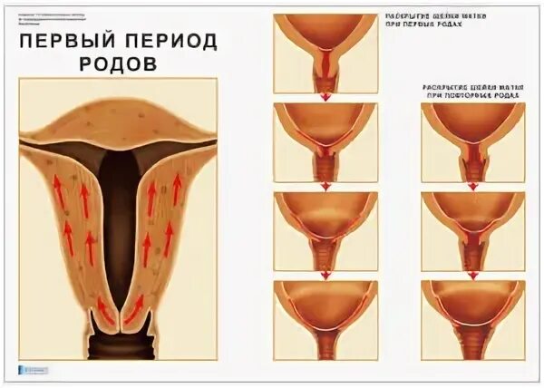 Почему шейка матки не готова