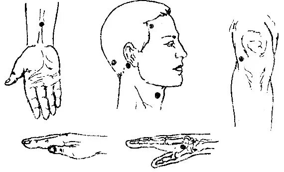 При давление какие точки массировать. Точечный массаж при гипертоническом кризе. Точки акупунктуры при гипертонической болезни. Точки акупунктуры при гипертонии. Акупунктурные точки для снижения давления при гипертонии.