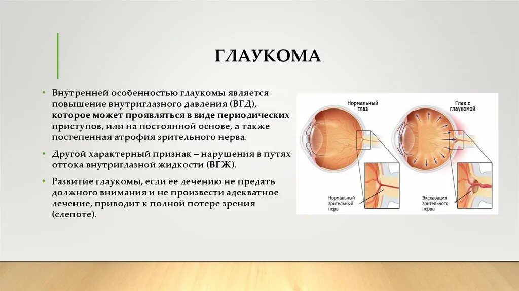 Презентация на тему глаукома. Повышение внутриглазного давления (глаукома).. Повышение внутриглазного давления симптомы. При глаукоме характерным признаком является.