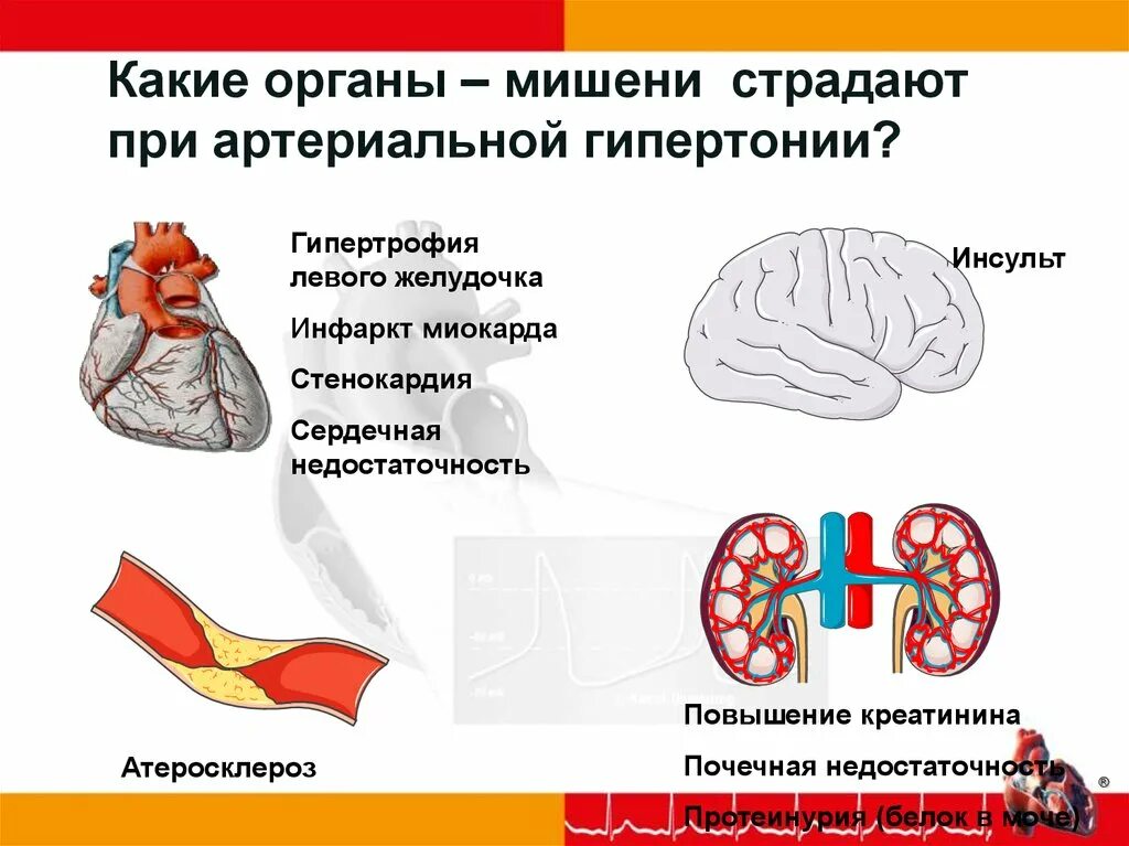 Органы мишени при артериальной. Органы-мишени при артериальной гипертензии. Гипертоническая болезнь органы мишени. Органы мишени артериальной гипертонии. Органы мишени при гипертонической.