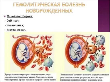 Гемолитическая болезнь
