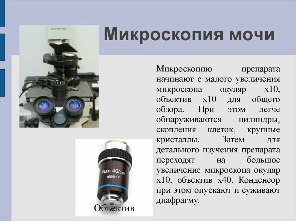 Увеличение окуляра 10 увеличение объектива 6. Увеличение объектива микроскопа. Объектив микроскопа. Микроскоп для исследования мочи. Объектив малого увеличения микроскопа.