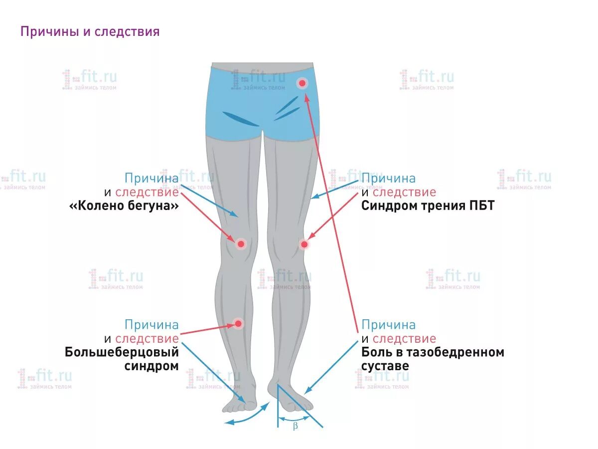 Почему болят ноги при ходьбе ниже колена. Боли вношах после бега. внутренняя сторона коле. боль с наружной стороны колена. внутренняя сторона колена.