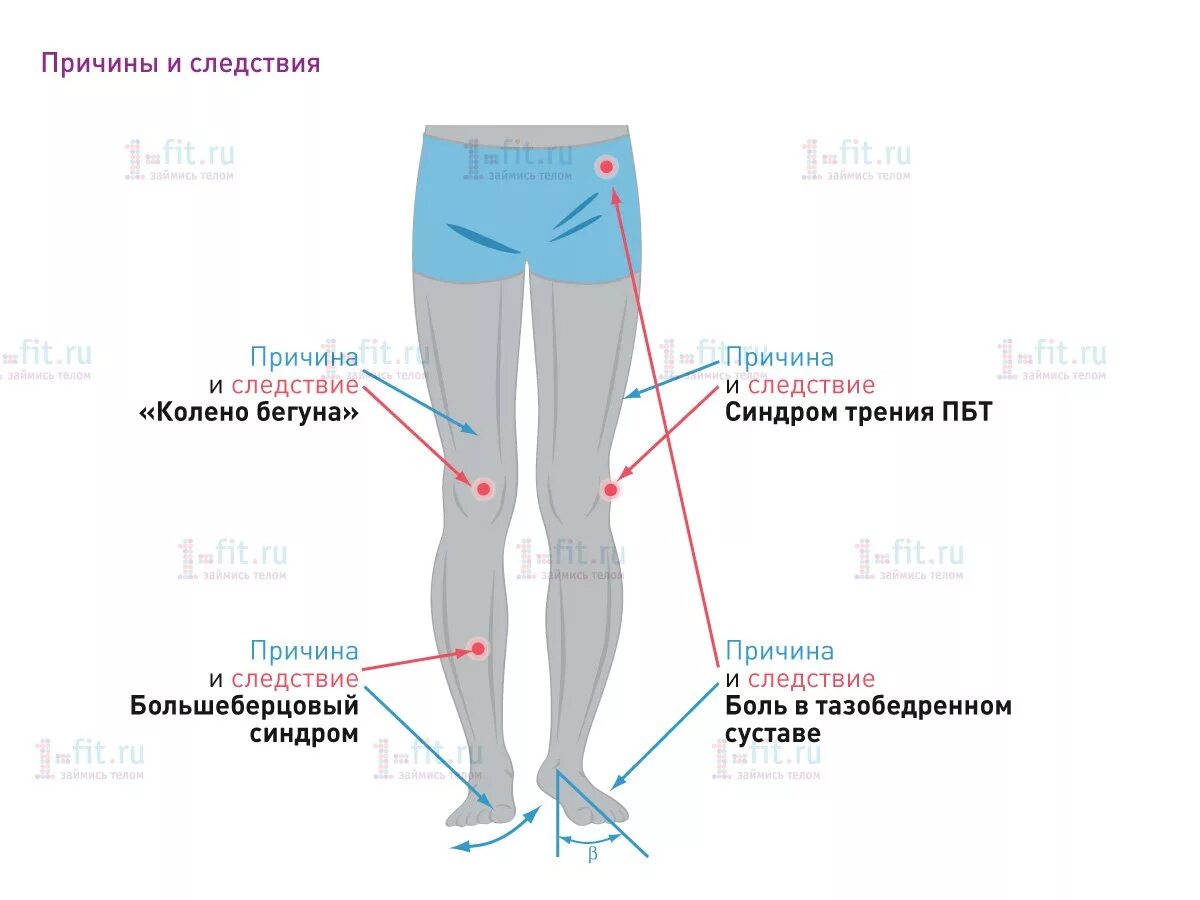 Почему тянет ногу от бедра до колена. Боли вношах после бега. Внутренняя сторона Коле. После бега болит под коленом.