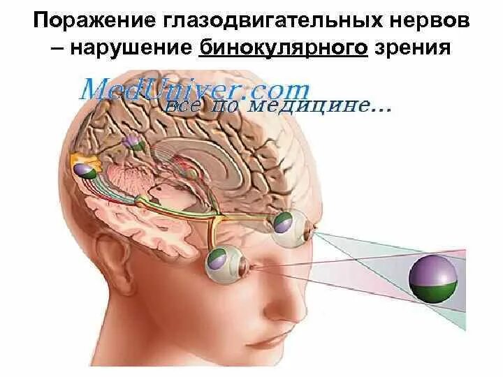 Зрительный нерв в головном мозге. Глаз зрительный нерв мозг. Зрительный нерв в голове. Головной мозг и глаза. Глаза и мозг взаимосвязь.