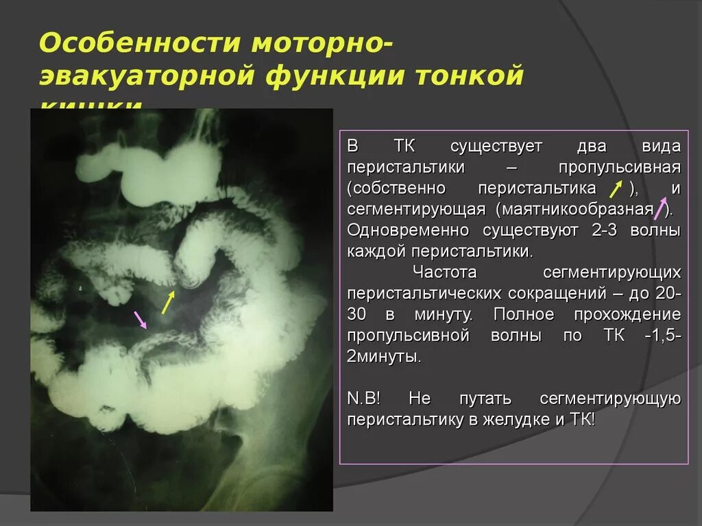Функции тонкого кишечника. Моторно-эвакуаторная функция тонкого кишечника. моторно-эвакуаторная функция кишечника что это. рентгенодиагностика заболеваний тонкой кишки. нарушение эвакуаторной функции кишечника.