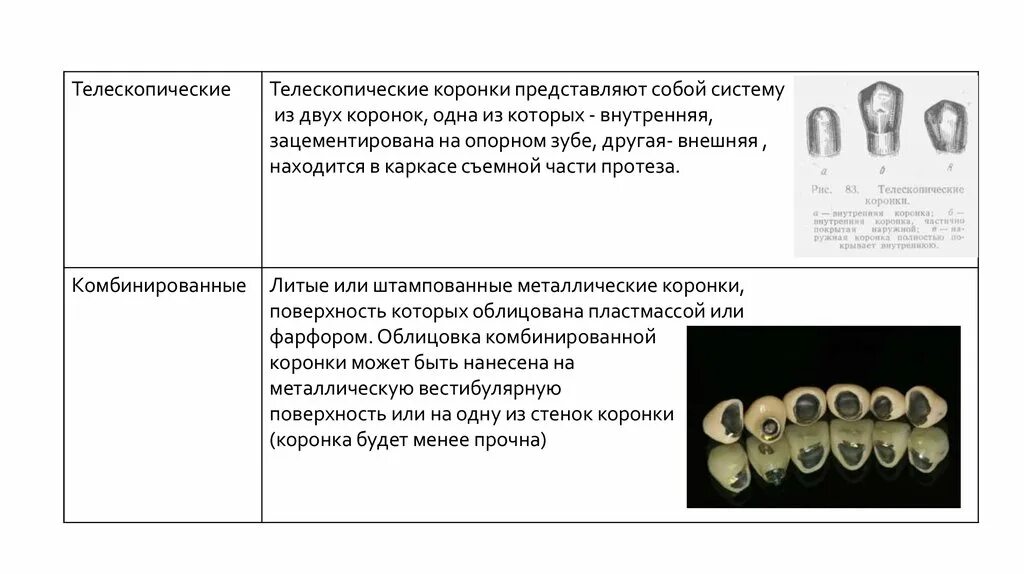 Показания к изготовлению телескопических коронок. Телескопические коронки показания. Классификация коронок ортопедическая стоматология. Показания металлических штампованных коронок. Какую функцию выполняет коронка зуба