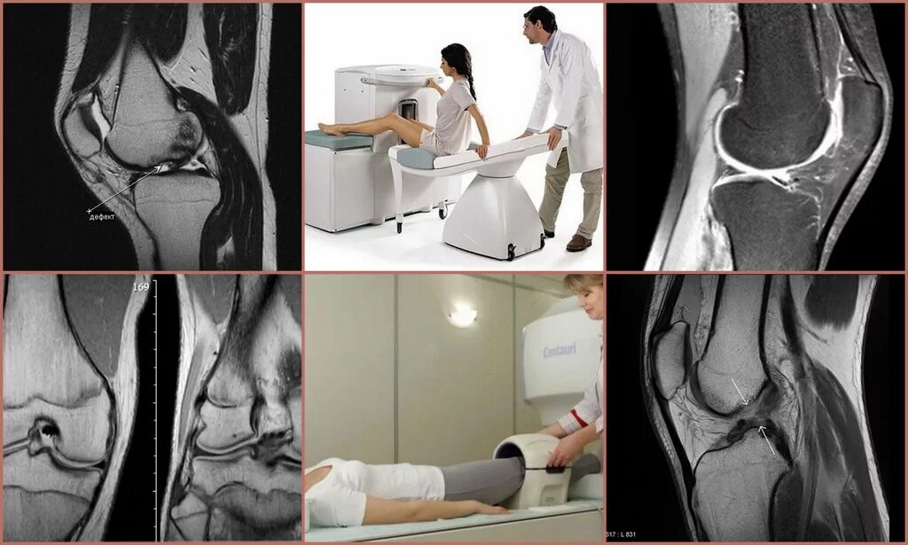 Имплант и мрт можно ли. Магниторезонансная томография коленного сустава. Магнитно-резонансная томография тазобедренных суставов. Функциональные пробы коленного сустава рентген. Магнитно-резонансный томограф коленного сустава.