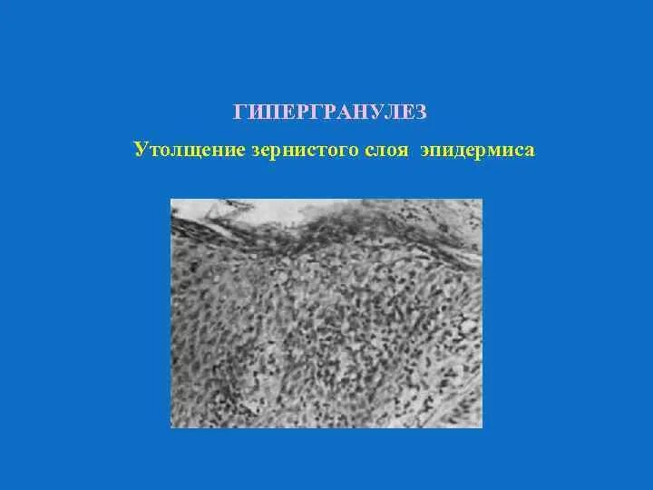 Неподвижный зернистый слой. Неподвижный зернистый слой
