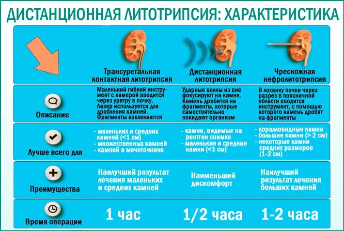 Дробление почечных камней. Дистанционная литотрипсия. Ультразвуковое дробление камней. Для измельчения камней в почках.