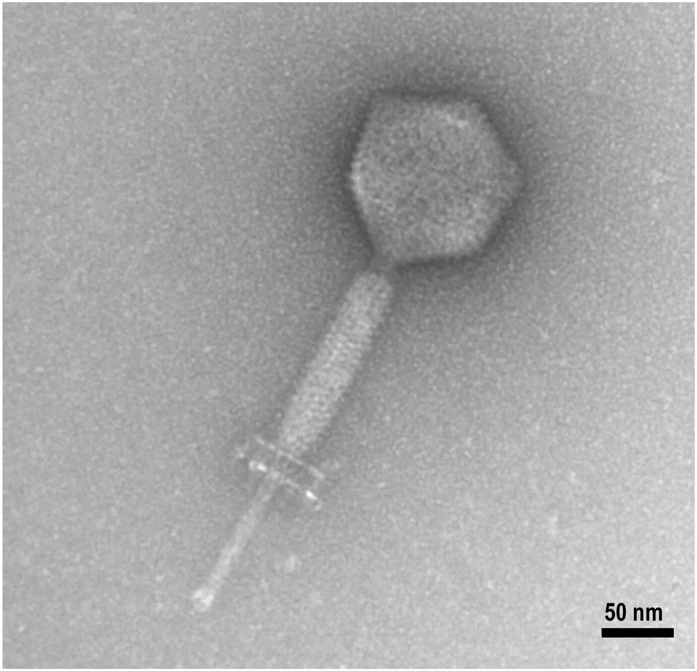 Enterococcus faecalis что это такое. Enterococcus faecalis что это такое