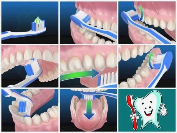 Техника чистки зубов. Правильная чистка зубов. Правильно чистить зубы. Схема чистки зубов. Как чистить десна