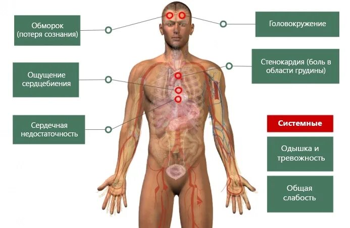 Синусовая тахикардия чсс 100 экг. Симптомы тахикардии у мужчин. Синусовая тахикардия сердца экг. Тахикардия. Клиника при наджелудочковой тахикардии.