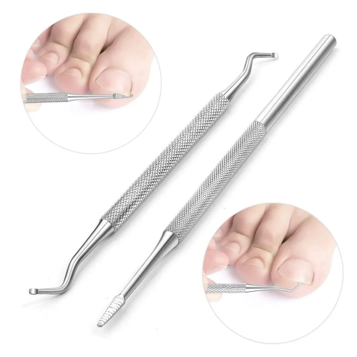 Инструмент для вросшего ногтя Makizume Robo. Кюретка Сталекс подо 10/1. Инкарнатор инструмент для педикюра. Кюретка для вросших ногтей.